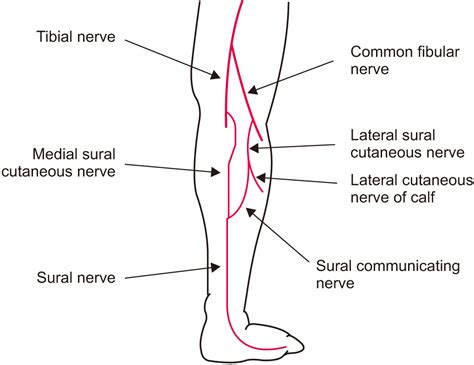 Sural Nerve Entrapment Cause Diagnosis Treatment