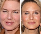 Renee Zellweger Before and After Transformation - Verge Campus