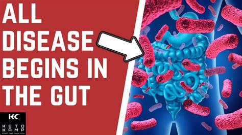 Does Leaky Gut Cause Autoimmune Disease Brain Fog And Medication Dr