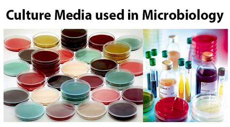 List Of Culture Media Used In Microbiology