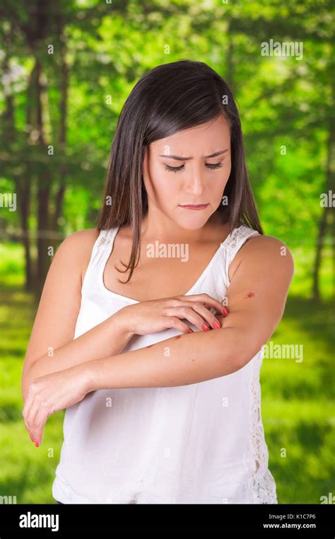 Close Up Of Young Woman Suffering From Itch After Mosquito Bites In A