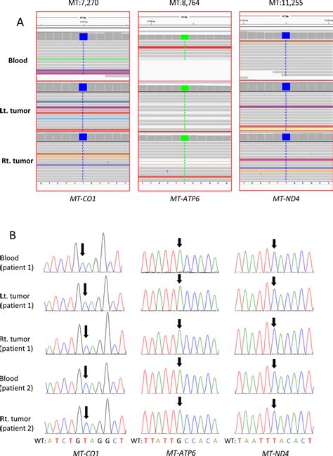 A Integrative Genomics Viewer Shows Three Mtdna Missense Mutations At