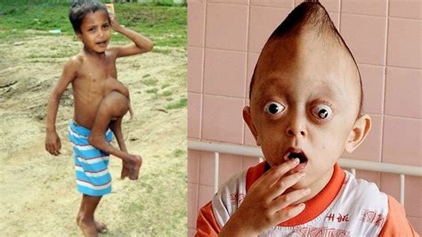 10 Unlucky Kids You Wont Believe Exist The Strangest Youtube