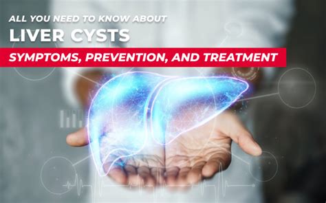 Liver Cysts Symptoms Prevention And Treatment Your Complete Guide