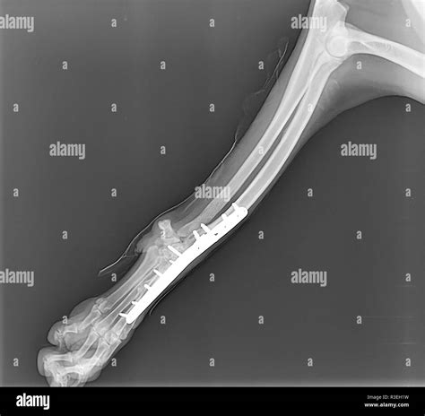 Right Foot Bones Hi Res Stock Photography And Images Alamy