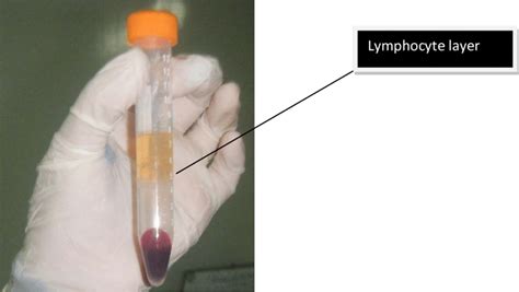 The Isolation Of Lymphocyte Layer Download Scientific Diagram