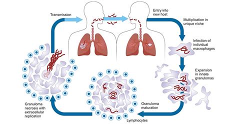 An Overview Of Tuberculosis TB CUSABIO