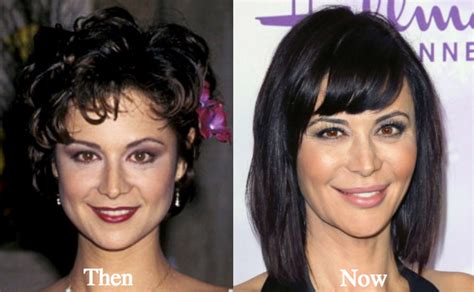 Catherine Bell Scar