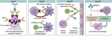 Immediate Hypersensitivity Type I Oncohema Key