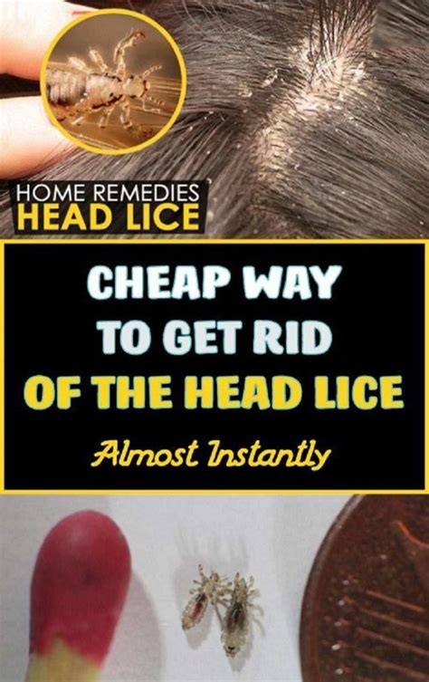 Cheap Way To Get Rid Of The Head Lice Almost Instantly Natural