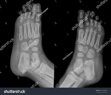 List 96 Wallpaper X Ray Of Person With Feet On Dashboard Completed 102023