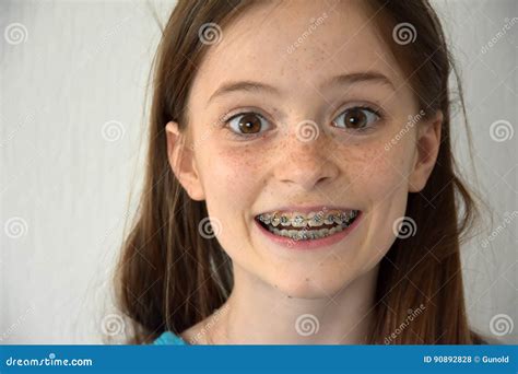 Girl Without And With Braces Vector Illustration