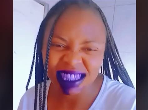 Woman Uses Gentian Violet To Whiten Her Teeth