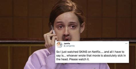 People Are Freaking Out Over Netflix Film About Deformities Called Skins