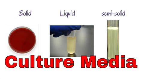 Culture Media In Microbiology Culture Media Microbiology Culture