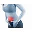 Acute Constipation Common And Easily Relieved  Eremedy Online