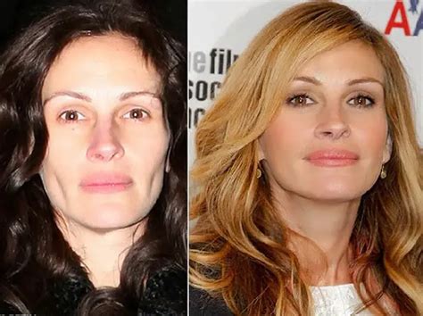 Julia Roberts Plastic Surgery Before And After Celebie