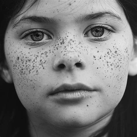 Love Freckles With Images Beautiful Freckles Freckles Freckle Face