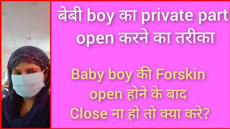 How To Open Baby Boy Private Partbaby का सुसु खोलने का तरीका पूरी
