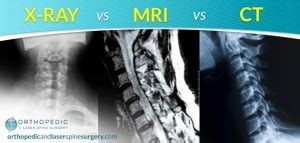 What S The Difference In X Rays Mris And Cts X Ray Vs Mri Vs Ct Scan