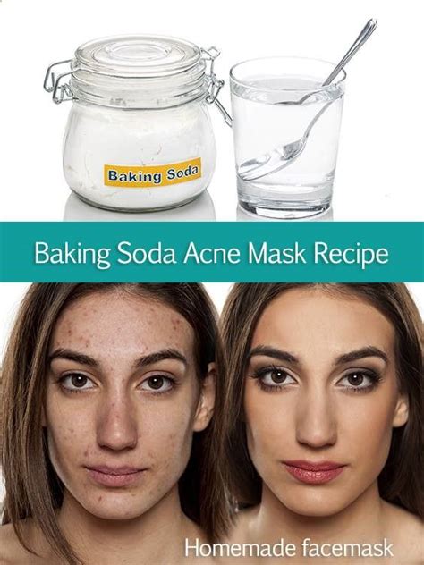 Baking Soda Acne Mask Recipe Baking Soda For Acne Baking Soda