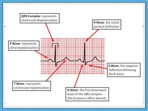 How To Read A Ecg Slidesharefile