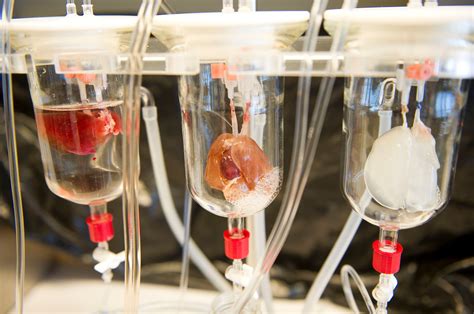 Scientists Make Progress In Tailor Made Organs The New