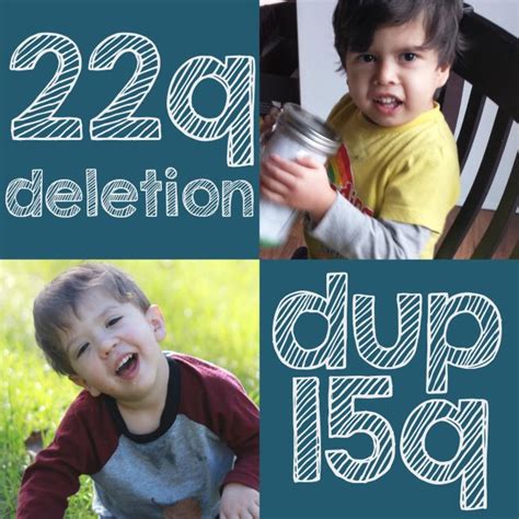 Digeorge syndrome results from microdeletion in a small segment of chromosome 22. Learn about 22q deletion syndrome and dup15q syndrome! 22q ...