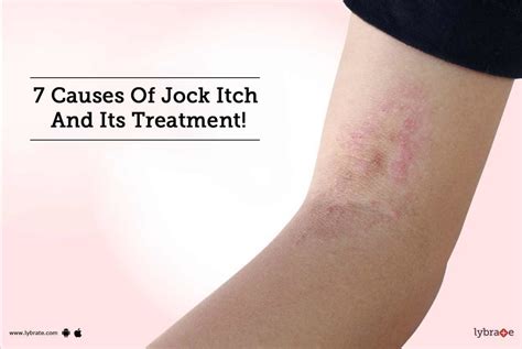 7 Causes Of Jock Itch And Its Treatment By Dr Akhilesh Sharma Lybrate