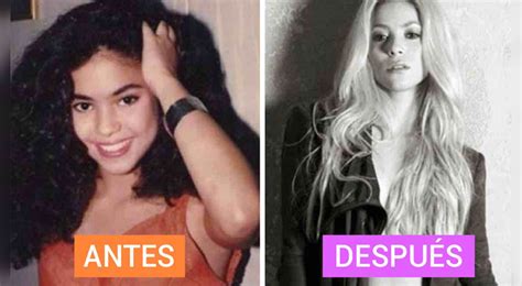 ¿cuántas Cirugías Se Ha Hecho Shakira En Su Vida Clínica Lo Revela