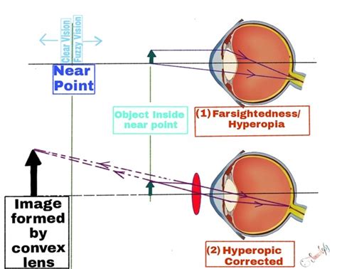 Optics Of Hyperopia Optography
