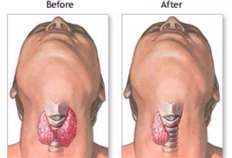 Simple Science: How to Make a Volcano with Kids