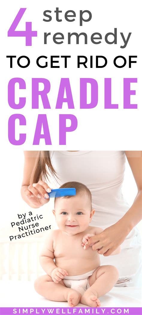Cradle Cap What Is It And How To Treat It Toddler Cradle Cap Cradle