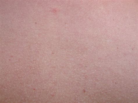 Текстура человеческой кожи много фото deviceart ru