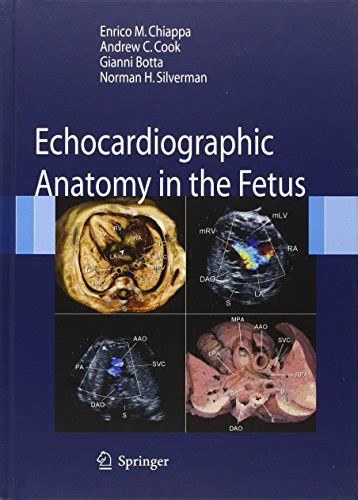 Echocardiographic Anatomy In The Fetus Medicine Clinic