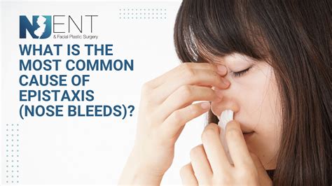 What Is The Most Common Cause Of Epistaxis Nosebleeds