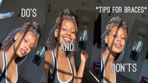 Do’s And Don’ts With Braces How I Feel Youtube