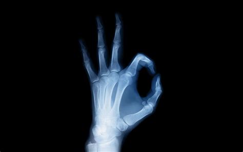Radiology Wallpapers Top Free Radiology Backgrounds Wallpaperaccess