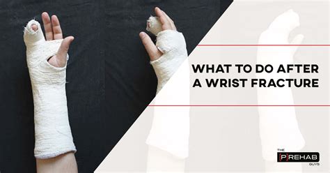 What To Do After A Wrist Fracture With Exercises 𝗣 𝗥𝗲𝗵𝗮𝗯