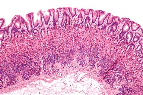 Filenormal Gastric Mucosa Low Mag