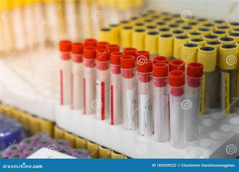 A Lot Of Blood Sample Tubes Empty In Laboratory Test Selective Focus