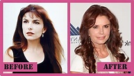 Roma Downey Plastic Surgery - Improved Her Looks