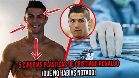 Las 5 cirugías plásticas que se hizo Cristiano Ronaldo Y tú ni cuenta