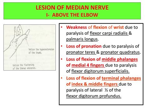 Ppt Median And Ulnar Nerves Powerpoint Presentation Id2171459