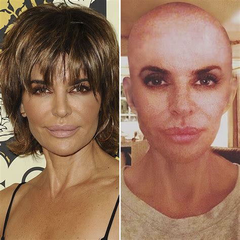 Lisa Rinna Has Gone Bald — Plus See More Drastic Celebrity Hair