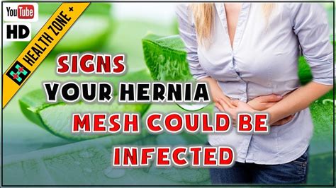 Other symptoms can vary depending on the complication or how the failure affects your body. 6 Signs Your Hernia Mesh Could Be Infected - YouTube
