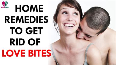 5 Home Remedies To Get Rid Of Love Bites Health Sutra Youtube