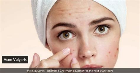 Acne Vulgaris And Its Management
