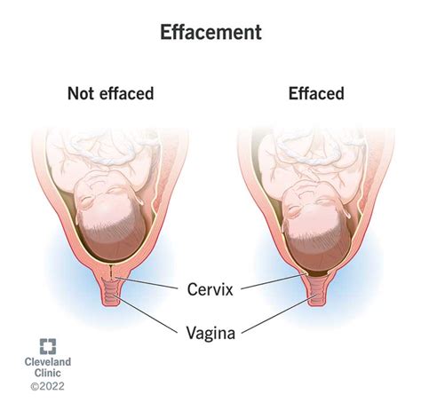 Cervix Before And During Pregnancy