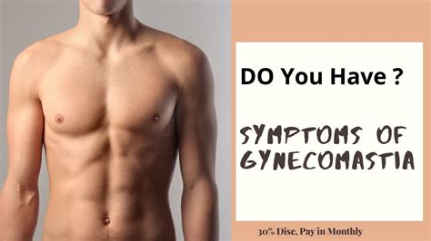 Symptoms Of Gynecomastia Gynecomastia Surgery Youtube